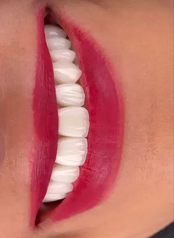 مژده به اهالی محترم گلباف در مورد دندانپزشکی|خدمات آرایشگری و زیبایی|گلباف, |دیوار