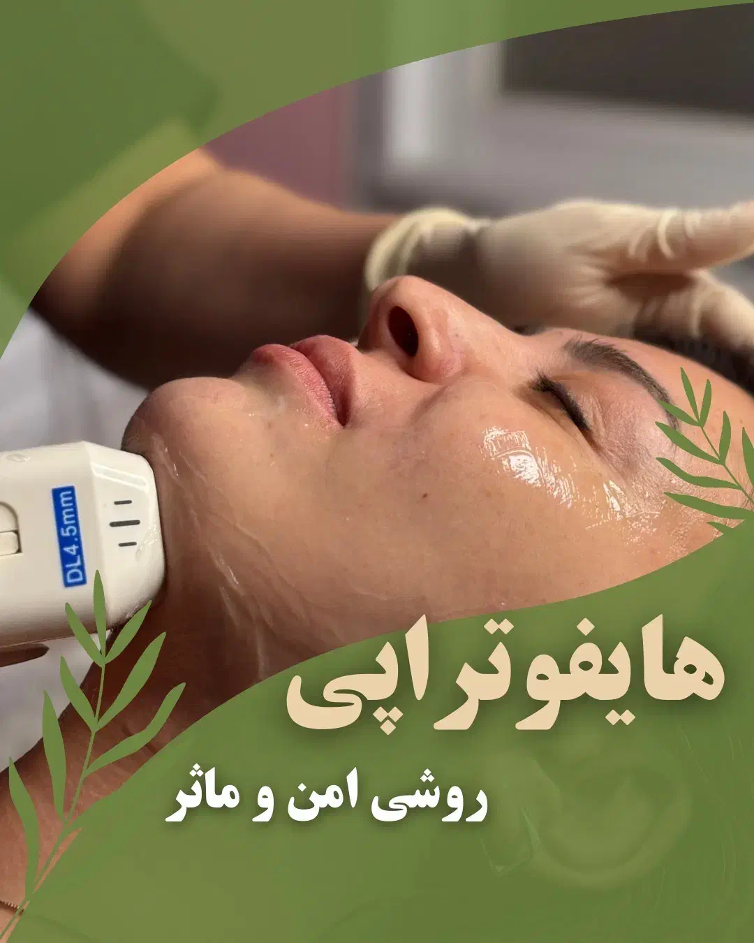 هایفوتراپی صورت. رفع غبغب. لاغری با قیمت ۲۵۰۰|خدمات آرایشگری و زیبایی|شاهین‌شهر, خانه کارگر|دیوار