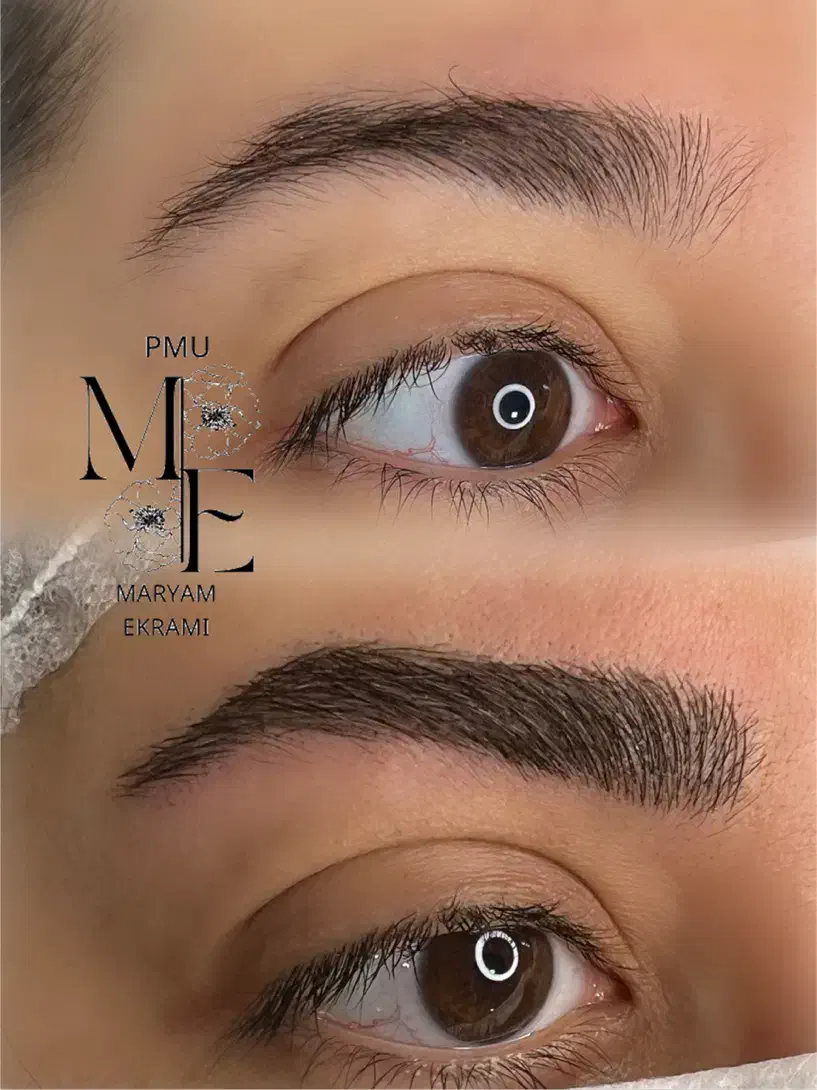 میکروبلیدینگ سوپر نچرال و ریموو تخصصی|خدمات آرایشگری و زیبایی|تهران, تهرانپارس جنوبی|دیوار