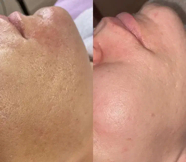 مرکز تخصصی پاکسازی صورت|خدمات آرایشگری و زیبایی|جم, |دیوار