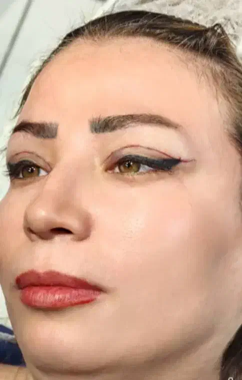 بلفاروپلاستی ،سانترال،دایرکت ابرو،کاشت vipجشنواره|خدمات آرایشگری و زیبایی|تهران, تجریش|دیوار