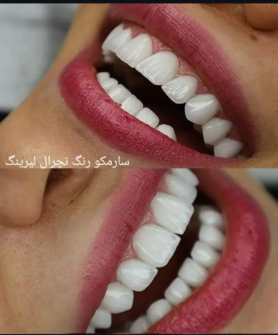 اموزش دندان سازی .ثابت ومتحرک وکامپوزیت|خدمات آرایشگری و زیبایی|شیراز, وصال|دیوار