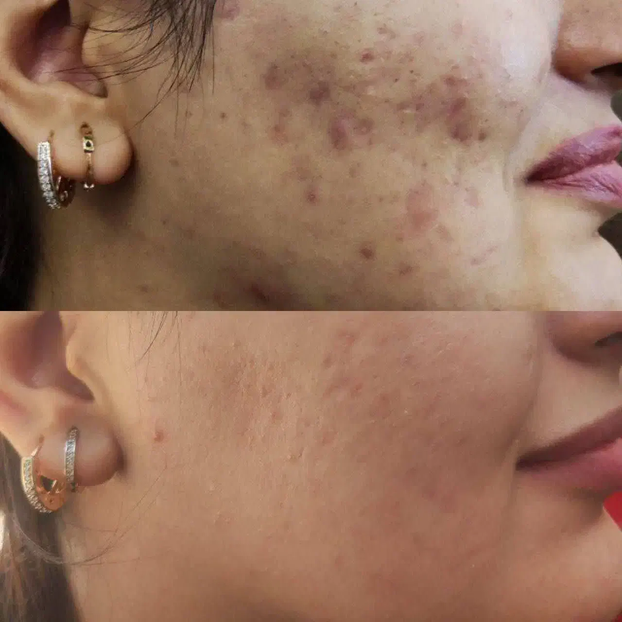 متخصص پوست و موهمراه مشاوره‌  وروتین پیشنهاد محصول|خدمات آرایشگری و زیبایی|اردبیل, |دیوار