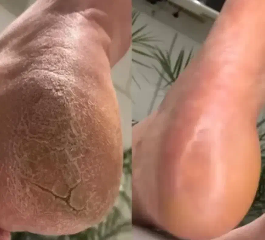 پدیکور کفسابی|خدمات آرایشگری و زیبایی|کاشان, شهرک امیرالمومنین|دیوار