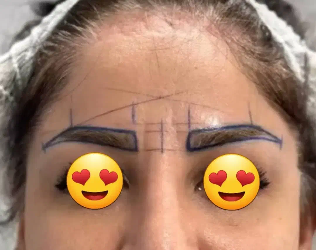 کاشت مو وابروتخصصی|خدمات آرایشگری و زیبایی|خرمشهر, |دیوار