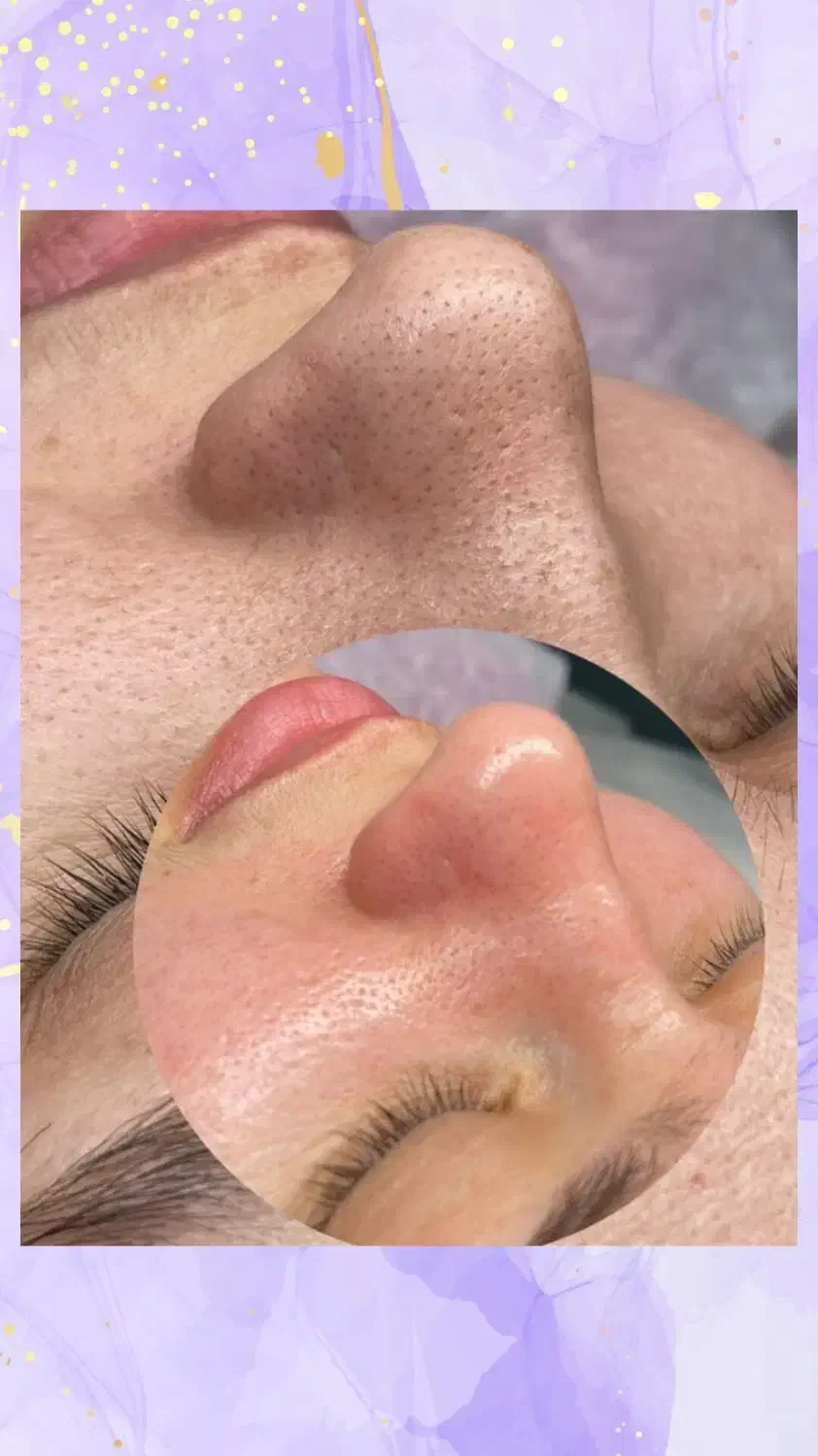 کلینیک زیبایی هوربانو جردن|خدمات آرایشگری و زیبایی|تهران, جردن|دیوار