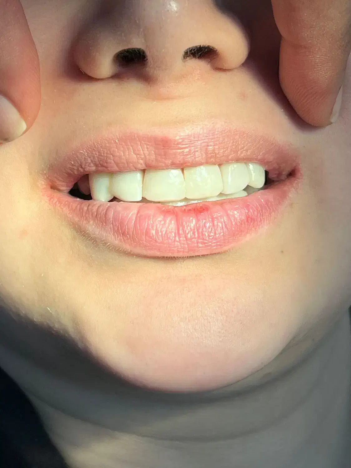 دندانپزشکی با پرداخت یک سوم هزینه|خدمات آرایشگری و زیبایی|سقز, |دیوار