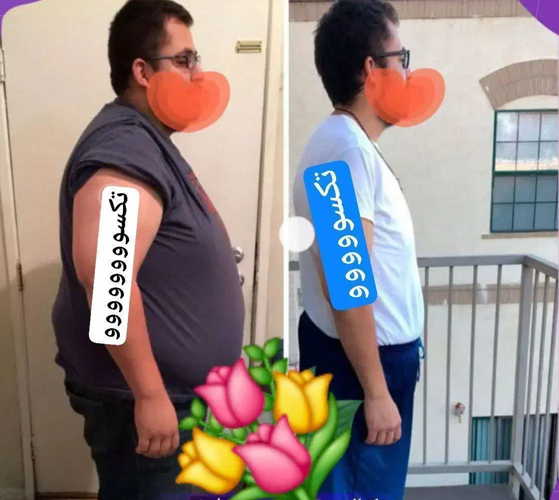 چربی سوزی مثل کره|آرایشی، بهداشتی، درمانی|زابل, |دیوار