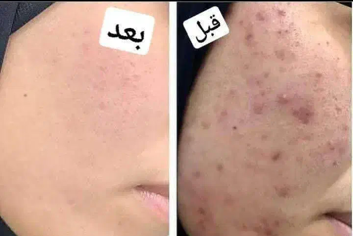 کرم وی آی پی تضمیمی|آرایشی، بهداشتی، درمانی|میبد, |دیوار