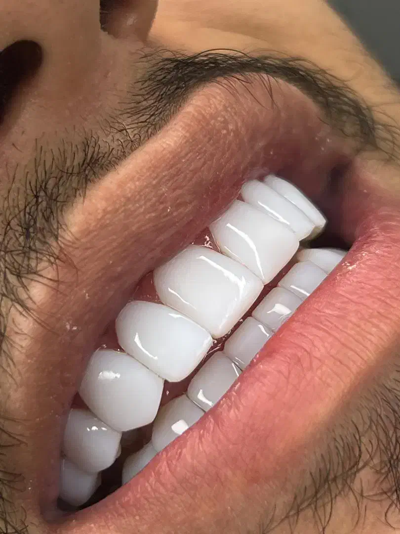 تخفیفات پاییزی کلینیک دیاموند|خدمات آرایشگری و زیبایی|زرندیه, |دیوار