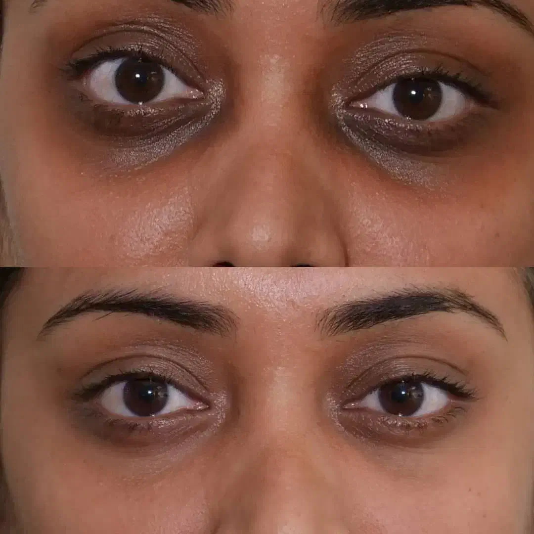 آفر پاکسازی صورت|خدمات آرایشگری و زیبایی|مشهد, ادیب نیشابوری (شهرک غرب)|دیوار