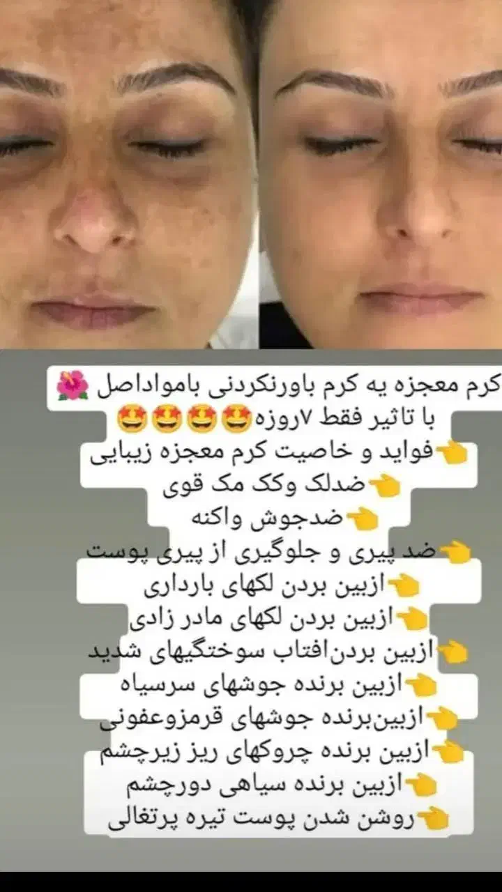 کرم معجزه اصل|آرایشی، بهداشتی، درمانی|ایوان, |دیوار