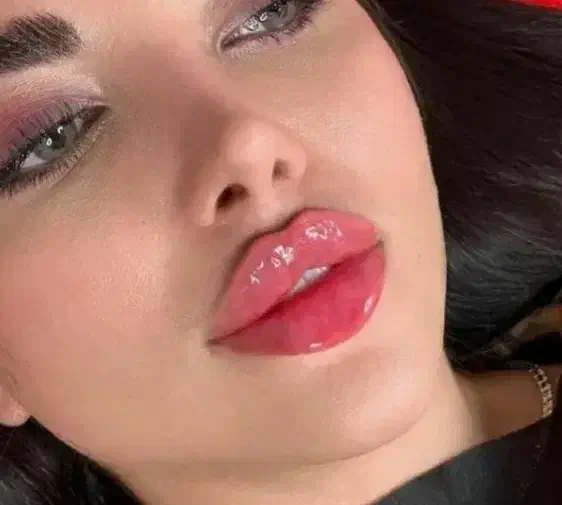 زیبایی لیفت بلفارو فرم بینی بوتاکس نخ ابروزاویه ژل|خدمات آرایشگری و زیبایی|اصفهان, خانه اصفهان|دیوار