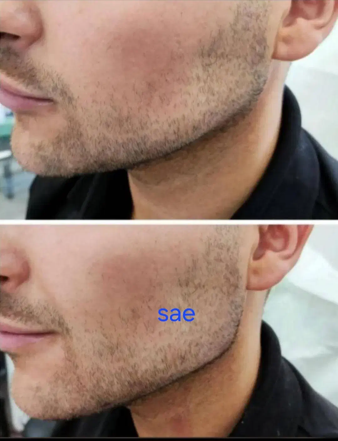 تزریق وآموزش تزریق ژل وبوتاکس ۲۵۰۰|خدمات آرایشگری و زیبایی|اهواز, طالقانی|دیوار