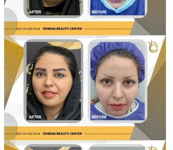 تور جراحی زیبایی بانوان|خدمات آرایشگری و زیبایی|ساری, |دیوار