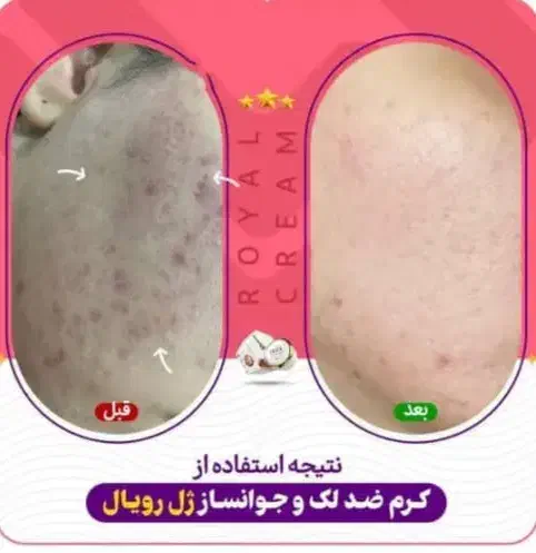 ژل کرم رویال|آرایشی، بهداشتی، درمانی|نورآباد ممسنی, |دیوار