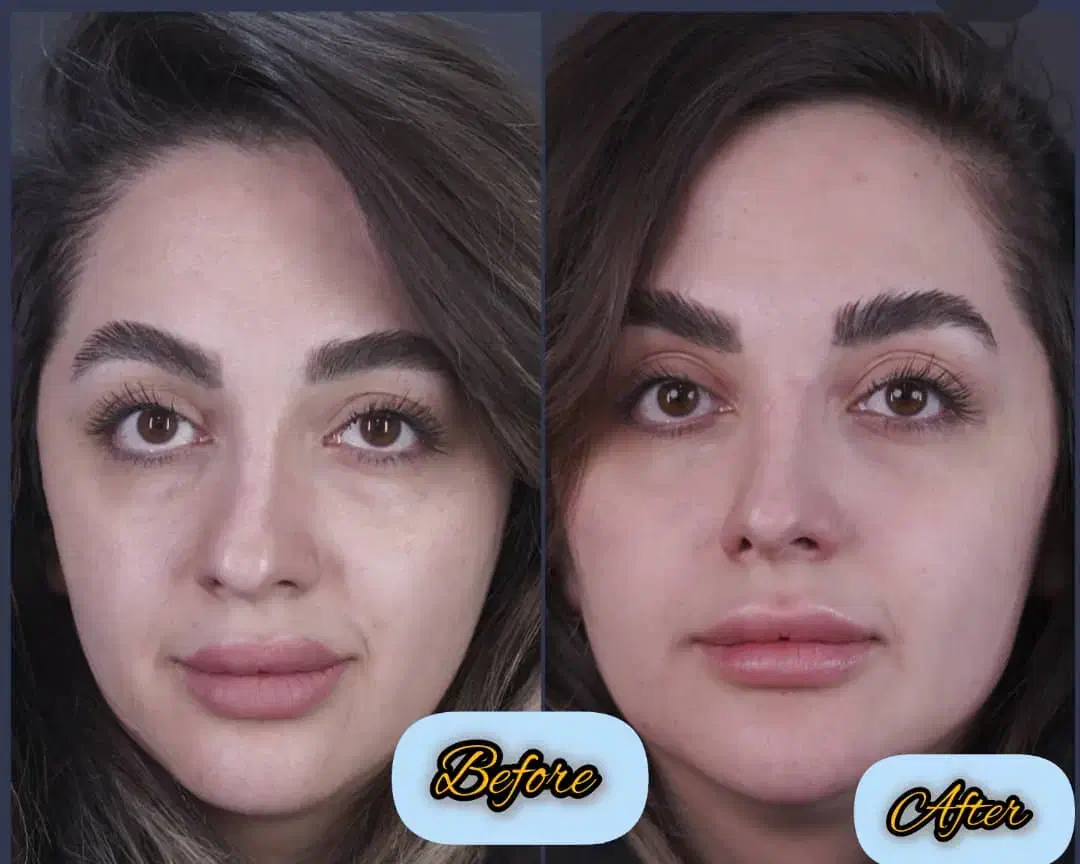 کلینیک تخصصی ژل و بوتاکس|خدمات آرایشگری و زیبایی|شاهین‌شهر, فردوسی|دیوار