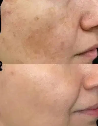 کرم معجزه گر|آرایشی، بهداشتی، درمانی|جیرفت, |دیوار