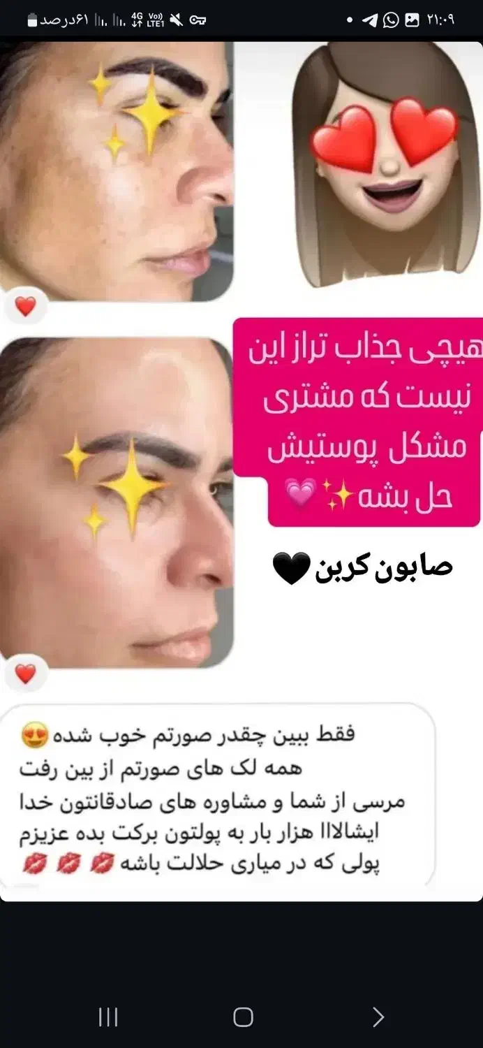 صابون وکرم فروشی|آرایشی، بهداشتی، درمانی|سرخنکلاته, |دیوار