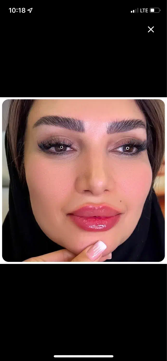 کلینیک لاغری|خدمات آرایشگری و زیبایی|تهران, صادقیه|دیوار