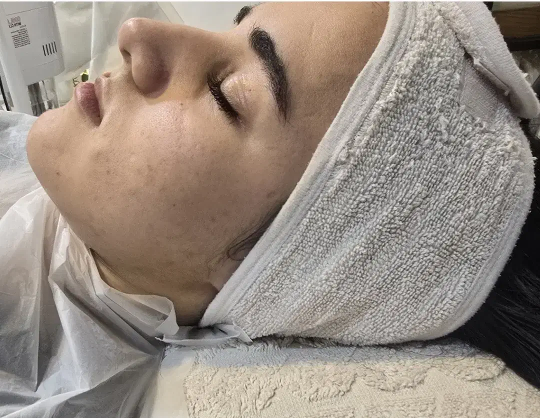 آموزش تخصصی فیشال و پاکسازی پوست|خدمات آموزشی|ارومیه, |دیوار