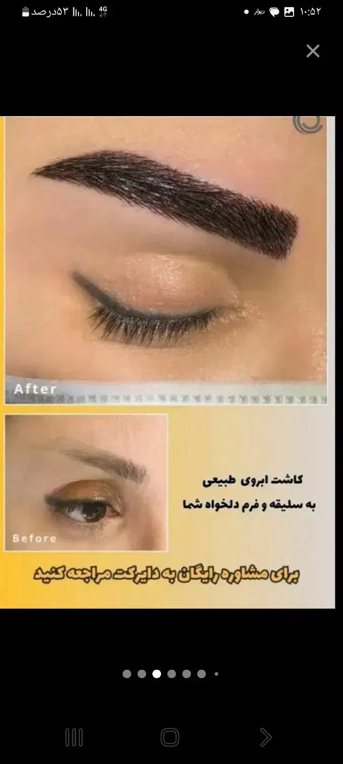 / کاشت مو و ابرو /بلفارو/ /عمل بینی ژل وبوتاکس|خدمات آرایشگری و زیبایی|تهران, دکتر هوشیار|دیوار