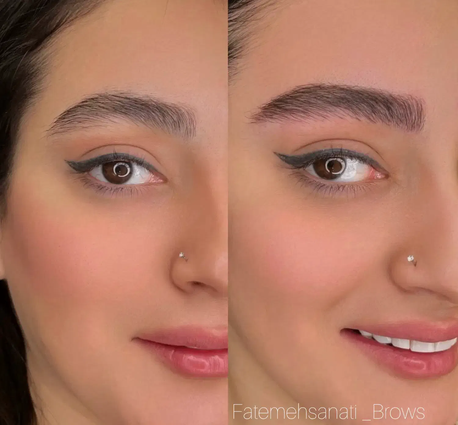 میکروبلیدینگ به روش کرکیمویی|خدمات آرایشگری و زیبایی|تهران, حر|دیوار