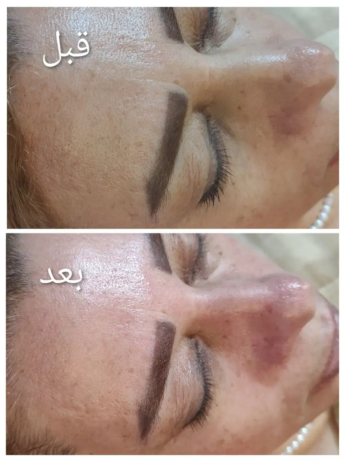 فیشیال تخصصی|خدمات آرایشگری و زیبایی|محمدشهر, محمدشهر|دیوار