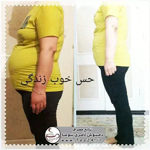 ۲۰روزه۸کیلو وزن کم کن|آرایشی، بهداشتی، درمانی|اردبیل, |دیوار