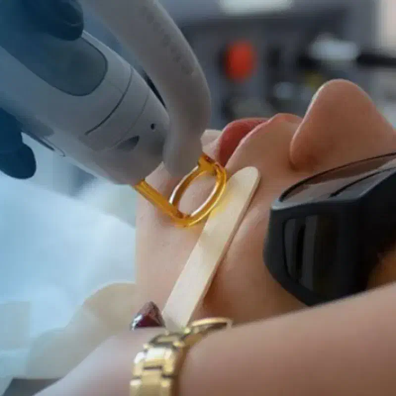 لیزر کندلا با قیمت دوسال پیش|خدمات آرایشگری و زیبایی|اصفهان, بهار آزادی|دیوار