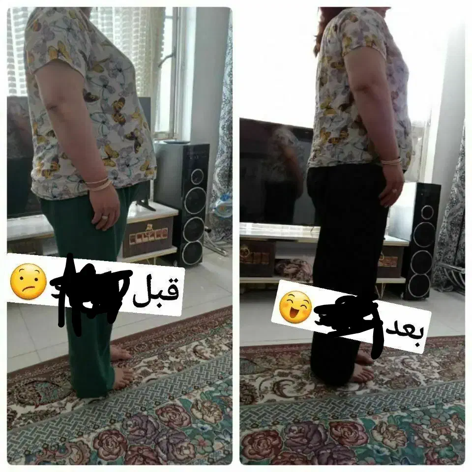 چربی سوزی شکم وپهلو|آرایشی، بهداشتی، درمانی|تبریز, |دیوار