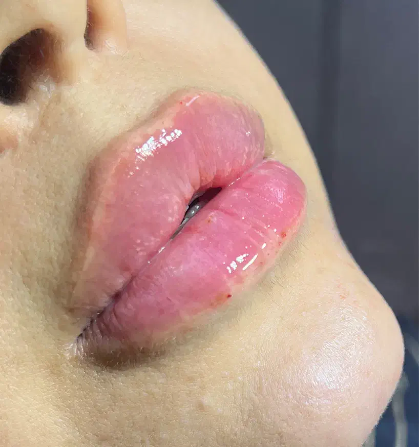 بوتاکس۵۹۰ فیلر۷۹۰لیزر فول بادی۷۵۰|خدمات آرایشگری و زیبایی|کیش, |دیوار