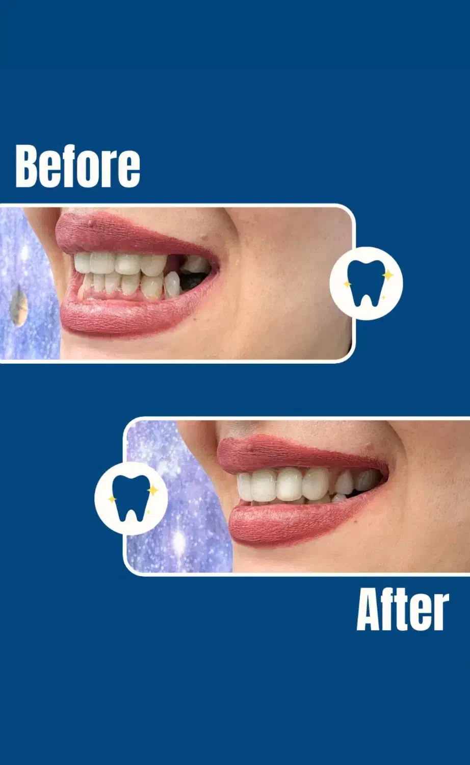 دندان مصنوعی اقساط و بیمه|خدمات آرایشگری و زیبایی|کرمان, |دیوار