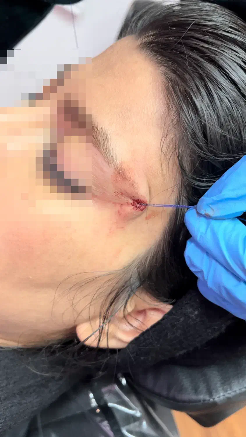 تزریق ژل و بوتاکس و مادلینگ عربی|خدمات آرایشگری و زیبایی|کرمانشاه, |دیوار