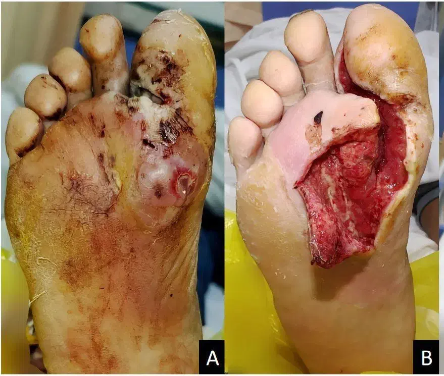 درمان دیابت تضمینی و تخصصی|خدمات آرایشگری و زیبایی|خاش, |دیوار