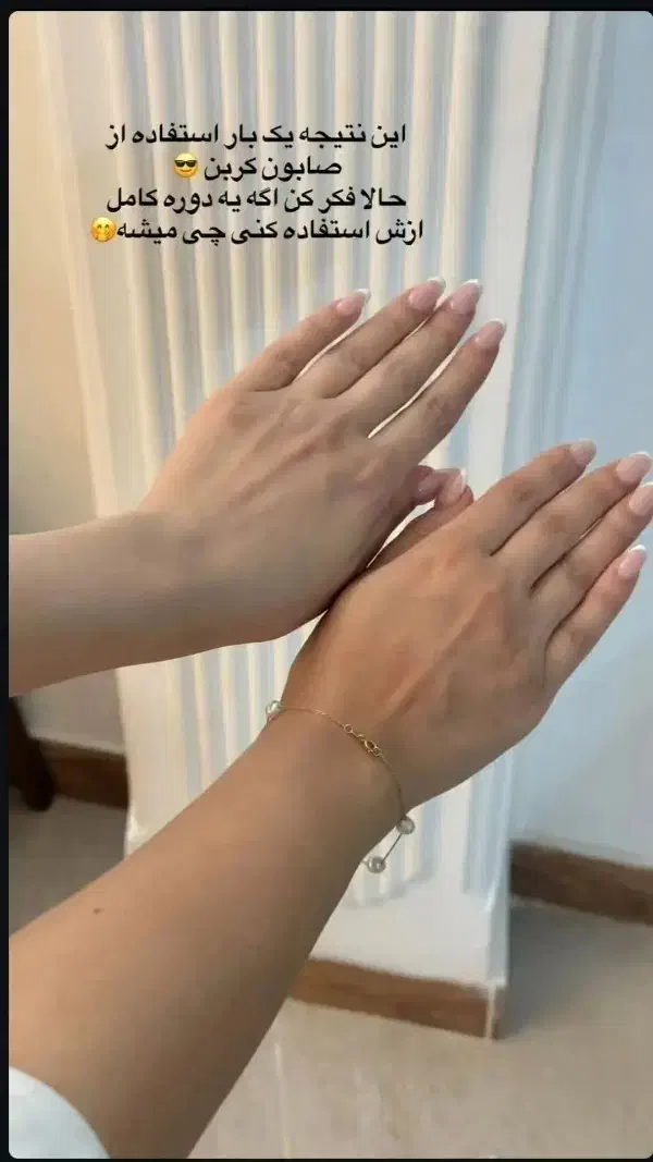 صابون زغال کربن|آرایشی، بهداشتی، درمانی|زنجان, |دیوار