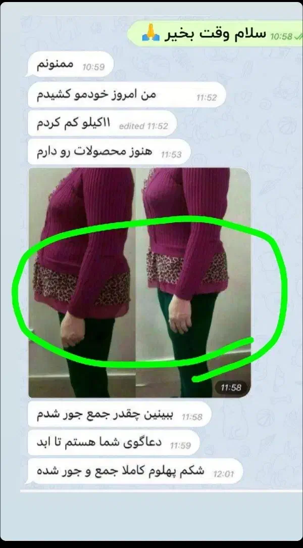 لاغری|آرایشی، بهداشتی، درمانی|بیرجند, |دیوار