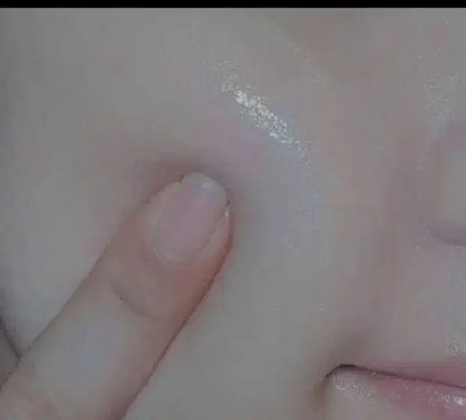 فرمول کرم روشن کننده ضدلک و ضدجوش تضمینی|آرایشی، بهداشتی، درمانی|زهک, |دیوار