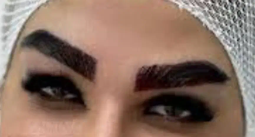 کاشت مو و کاشت ابرو، میکروگرافت|خدمات آرایشگری و زیبایی|کرمانشاه, |دیوار