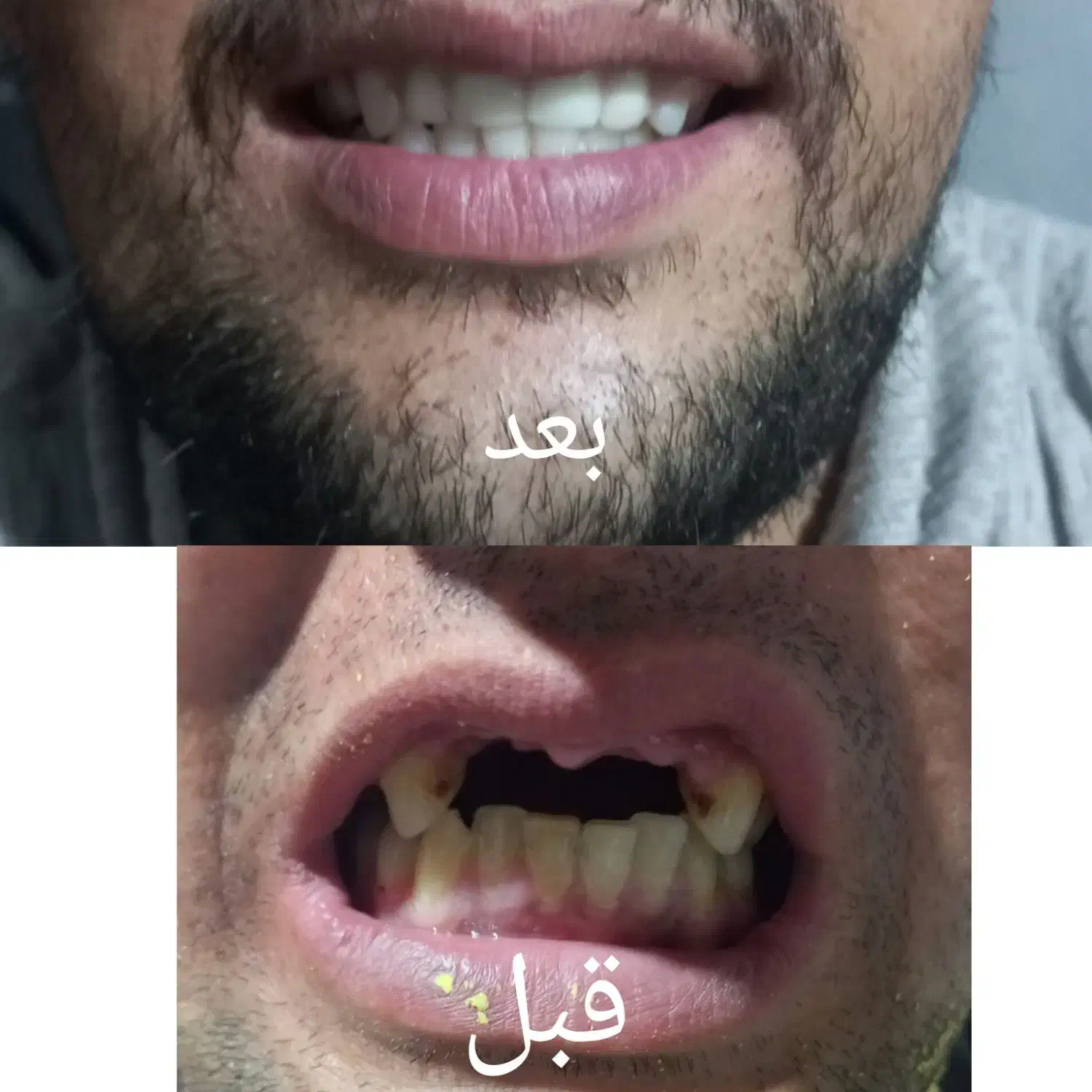 دندان سازی|خدمات آرایشگری و زیبایی|گنبد کاووس, |دیوار