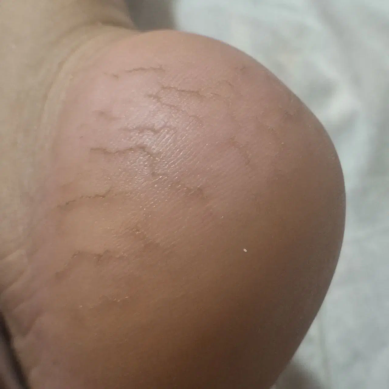 پدیکور درمانی آقایان در کلینیک پوست دریک‌جلسه|خدمات آرایشگری و زیبایی|پردیس, فاز ۲|دیوار