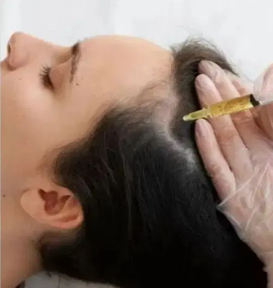 پی آر پی حجامت بادکش گرم فصد خون زالو مزاج شناسی|خدمات زیبایی و سلامت|تهران, مجیدیه|دیوار