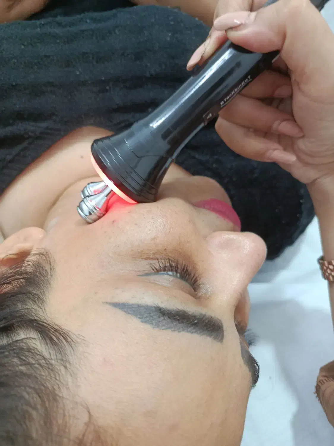 فیشیال تخصصی درمانی تخفیف ویژه امروز|خدمات آرایشگری و زیبایی|بم, |دیوار