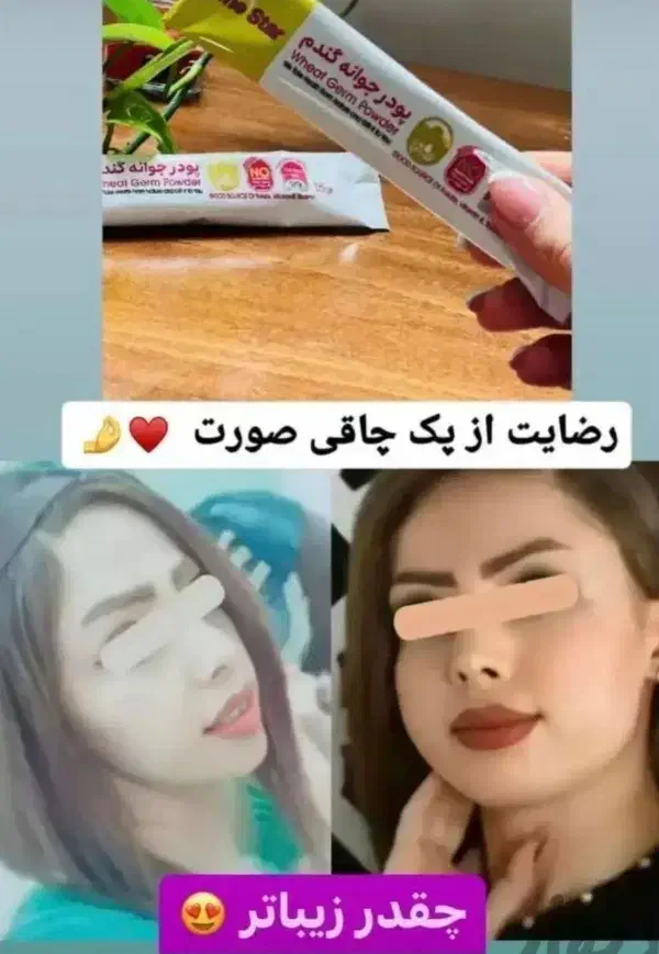 پک چاقی صورت * تضمینی*|آرایشی، بهداشتی، درمانی|قم, شهید رجایی|دیوار