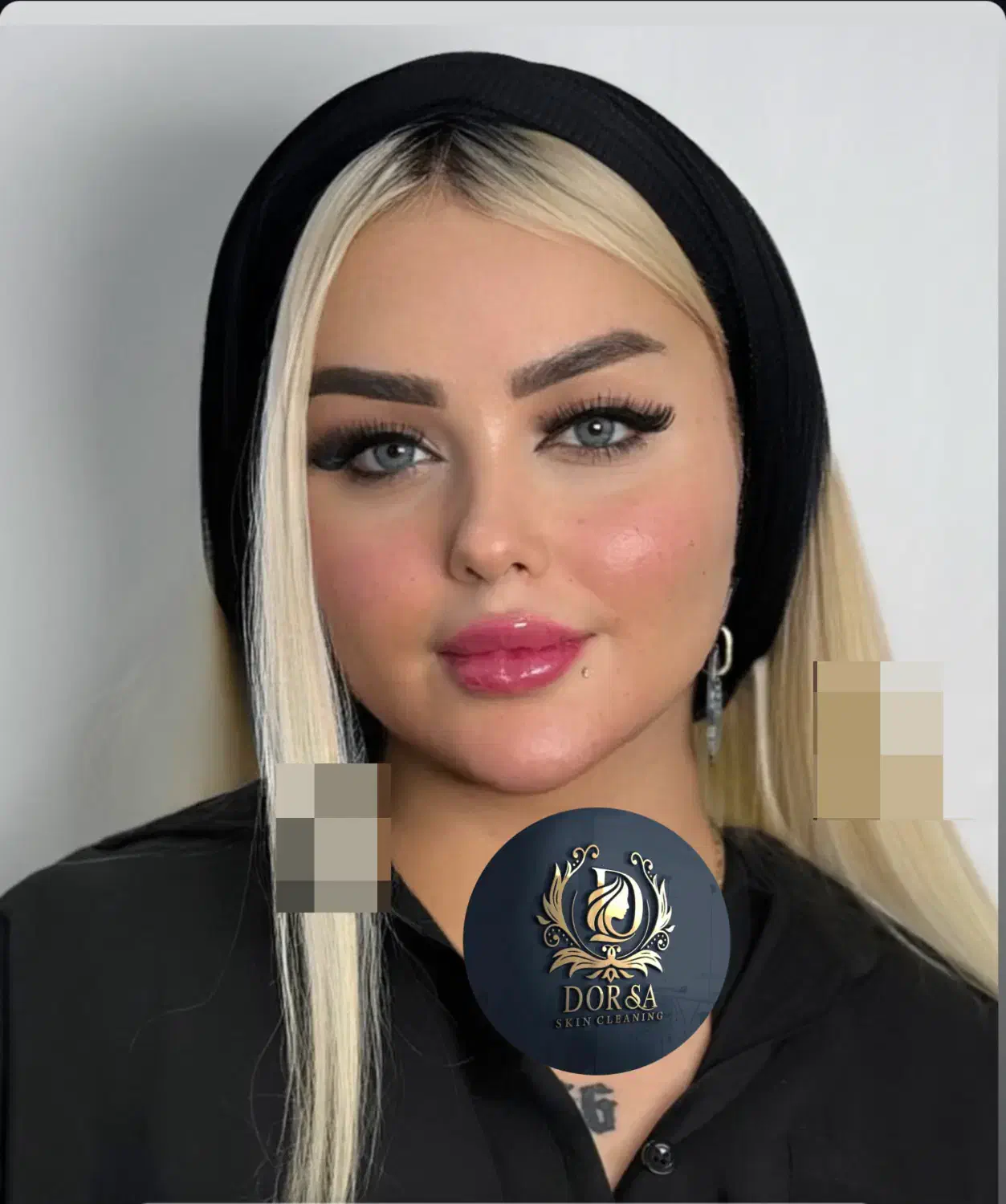 تزریق تخصصی ژل ومادلینگ خلیجی واروپایی وبوتاکس|خدمات آرایشگری و زیبایی|کرمانشاه, |دیوار