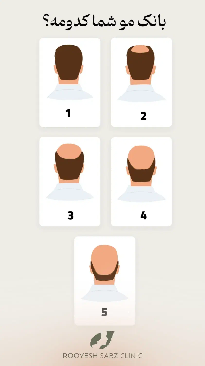 کاشتمو و ابرو|خدمات آرایشگری و زیبایی|تهران, جردن|دیوار