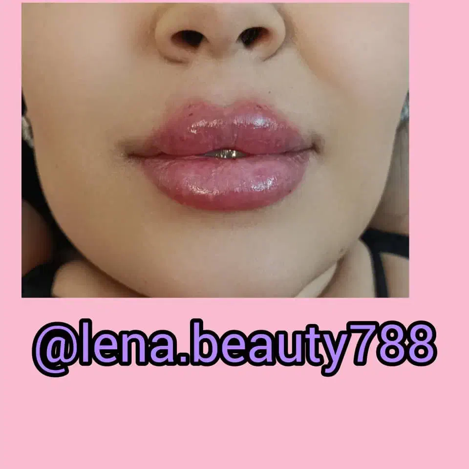 خدمات ژل فقط ۵۸۰ وبوتاکس ۷۵۰ در مطب|خدمات آرایشگری و زیبایی|نجف‌آباد, حومه نجف آباد|دیوار