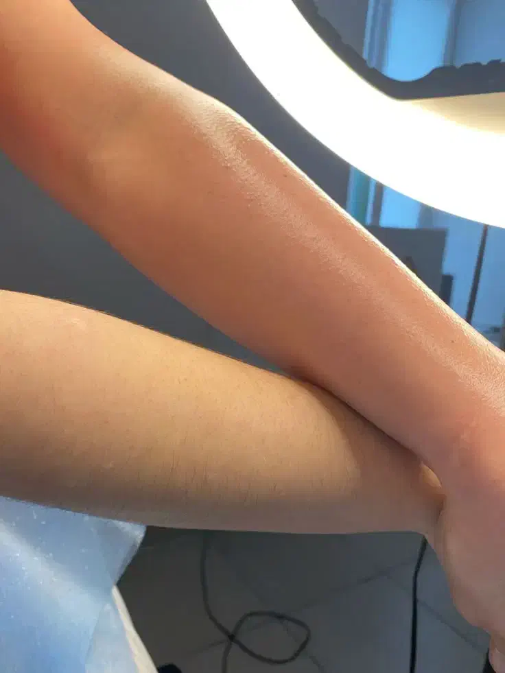 جشنواره زمستانه لیزرموهای زائد ریزش تضمینی در مطب|خدمات آرایشگری و زیبایی|زنجان, |دیوار