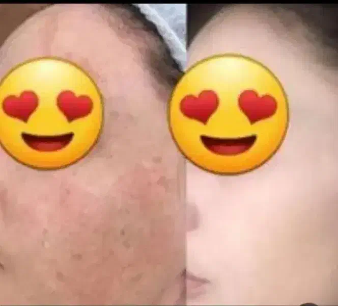 کرم معجزه اصل|آرایشی، بهداشتی، درمانی|یاسوج, |دیوار