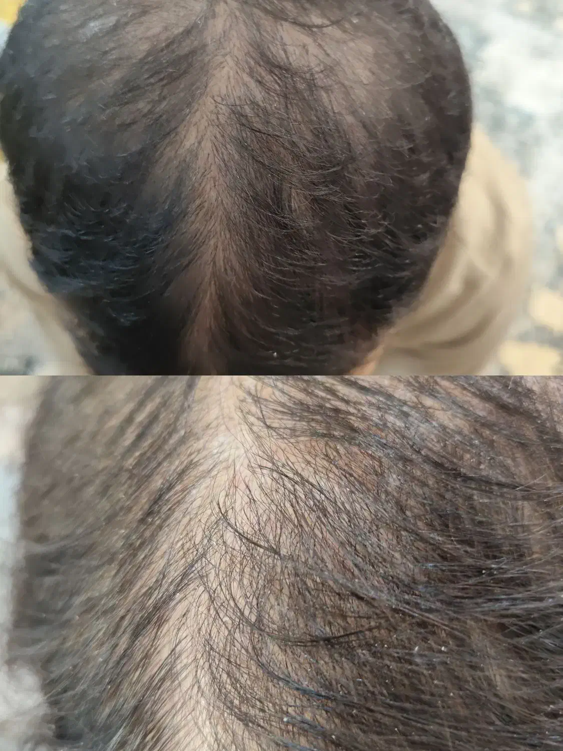 آف تخلیه غبغب وپی ارپی|خدمات آرایشگری و زیبایی|خرمشهر, |دیوار